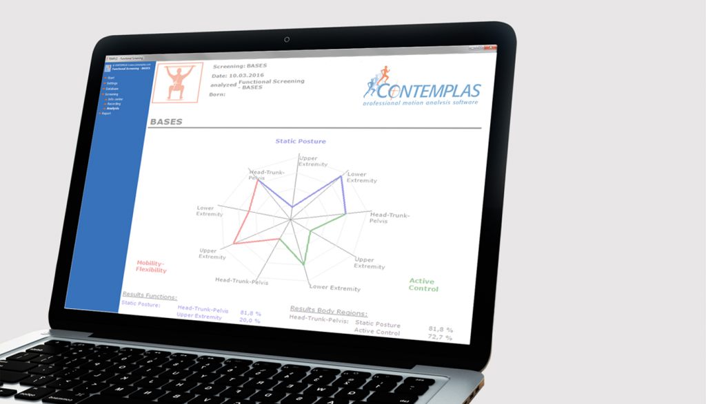 картинка Система анализа производительности и функционального контроля Contemplas от магазина K4SPEED
